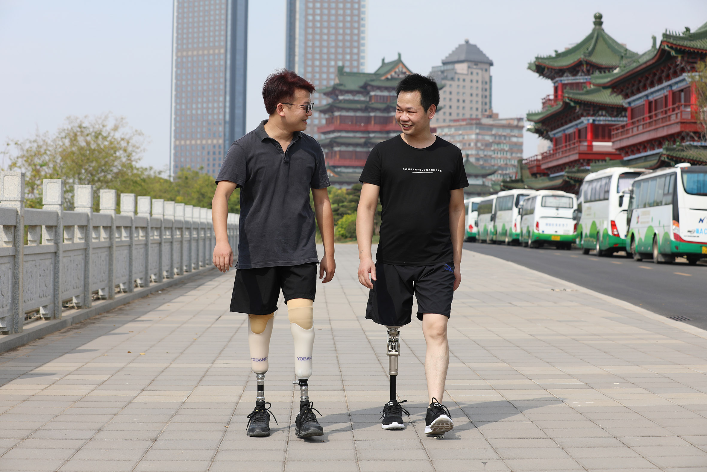 大腿假肢装配需要注意的问题_患者